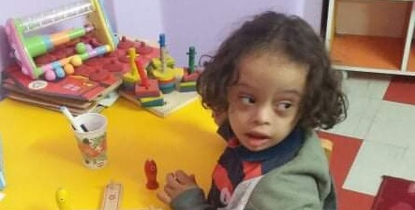 قصي الطفل المصاب بمتلازمة داون