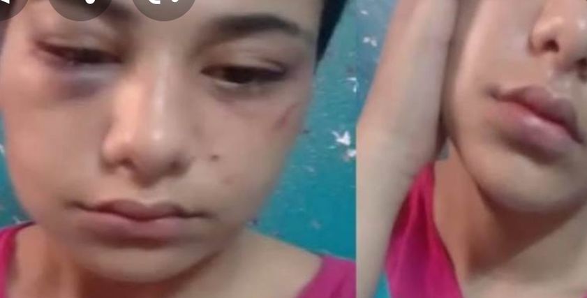 منة عبد العزيز