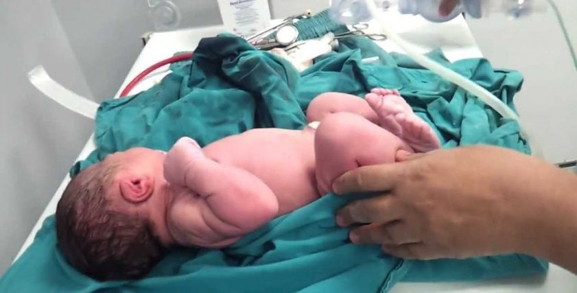 وفاة الام ومعجزة تنقذ الطفلة المولودة