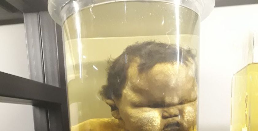 بالصور| افتتاح متحف نجيب محفوظ لأمراض النساء والتوليد