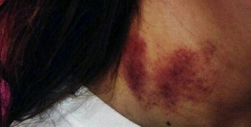 طرق إخفاء ومعالجة بصمة