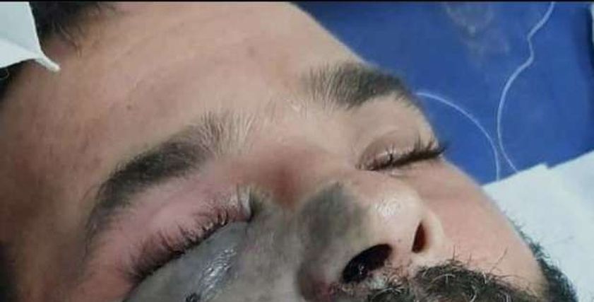 الفطر الأسود المميت