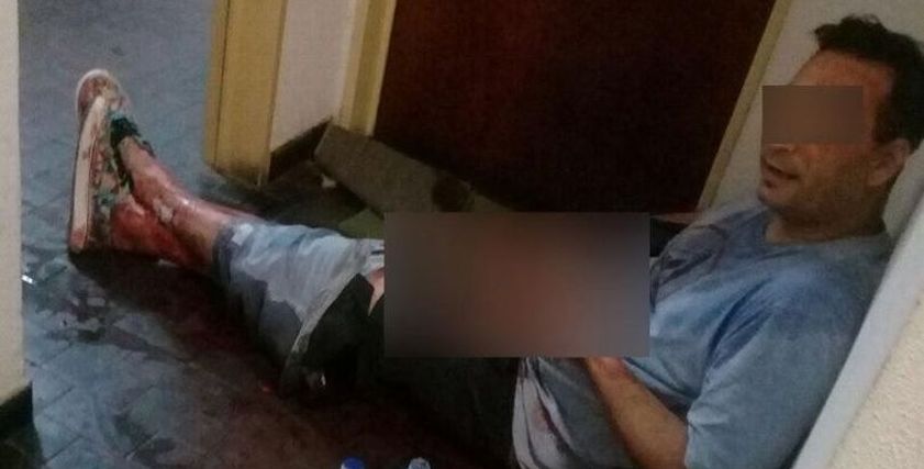 بالصور| سيدة أرجنتينية تعترف بقطع عضو صديقها الذكري: