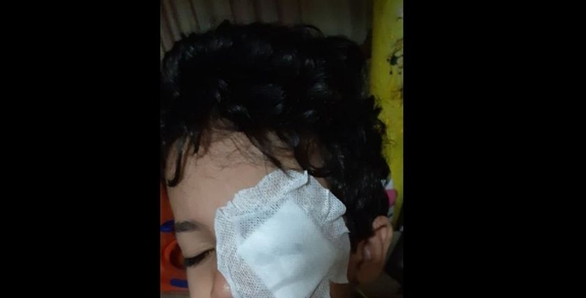 طالب يتعرض لقطع في قرنية العين