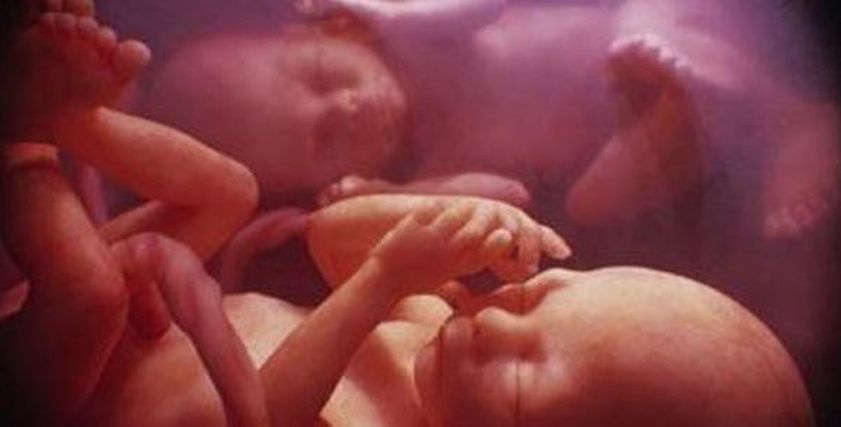 حالة نادرة.. امرأة لديها رحمين وولدت طفل من كل منهما