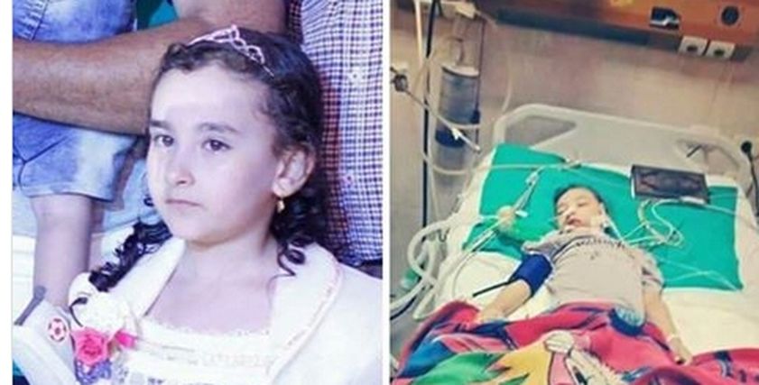 الطفلة قبل وبعد إجراء العملية