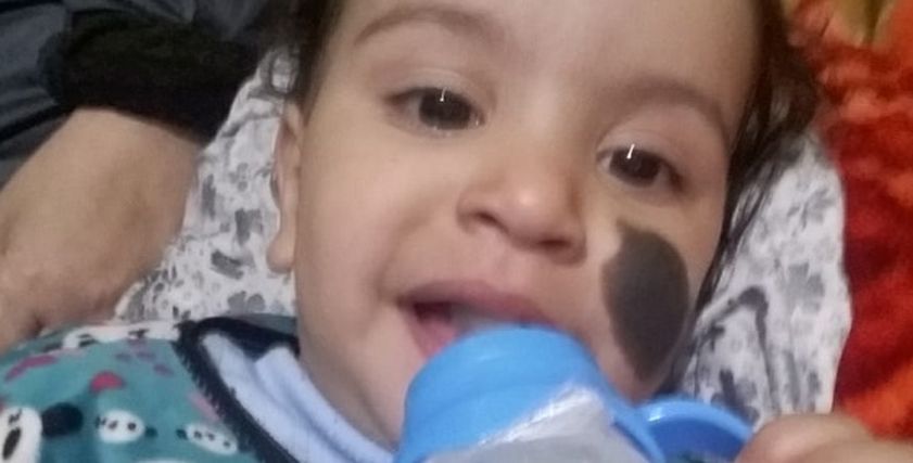 رضيعة التعرية