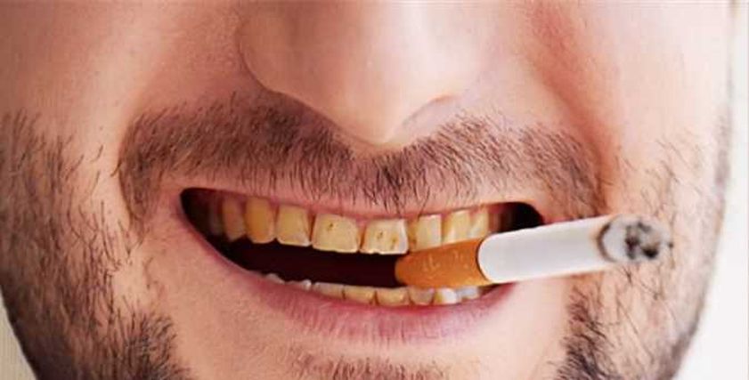 أسنان المدخنين