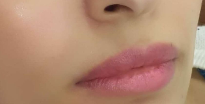 حسنة صناعي