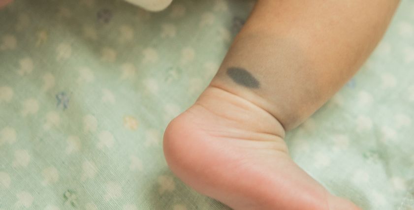 أسباب ظهور بقع زرقاء في الجسم عند الأطفال