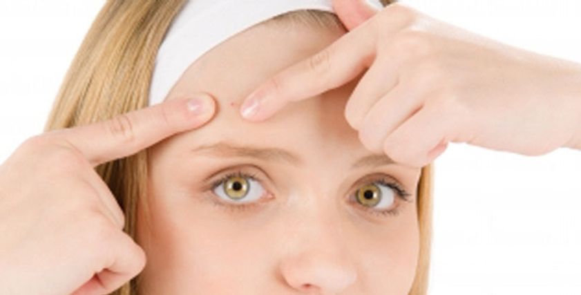 آثار حب الشباب