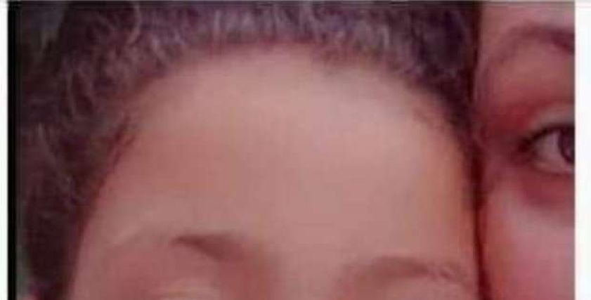 الطفلة الضحية