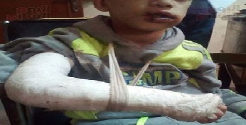 صورة أرشيفية لأحد ضحايا العنف