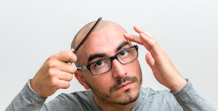 لتجنب مشاكل الصلع عند الرجال.. تناولوا هذه الأطعمة